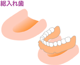 総入れ歯治療例