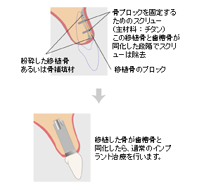 ボーンクラフト