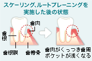 再評価